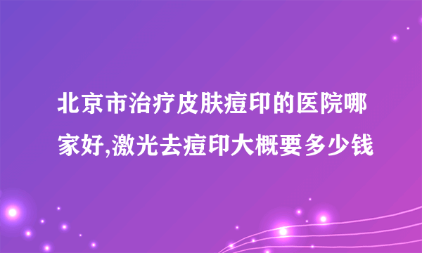 北京市治疗皮肤痘印的医院哪家好,激光去痘印大概要多少钱