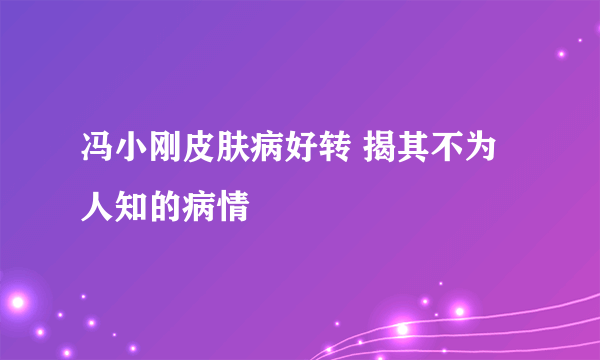 冯小刚皮肤病好转 揭其不为人知的病情