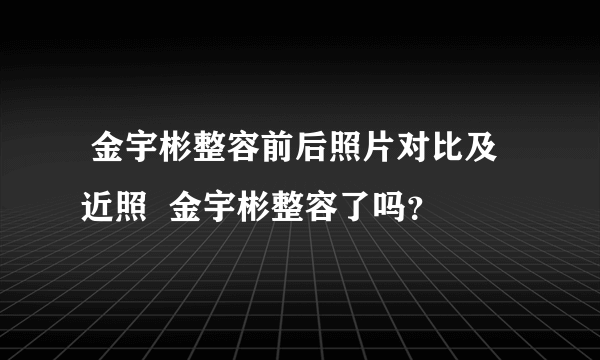  金宇彬整容前后照片对比及近照  金宇彬整容了吗？