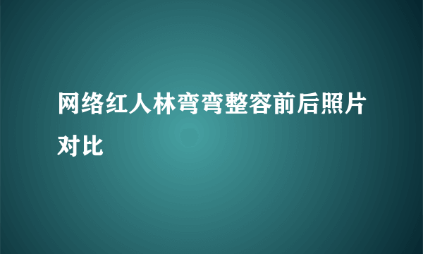 网络红人林弯弯整容前后照片对比