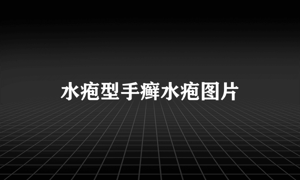 水疱型手癣水疱图片