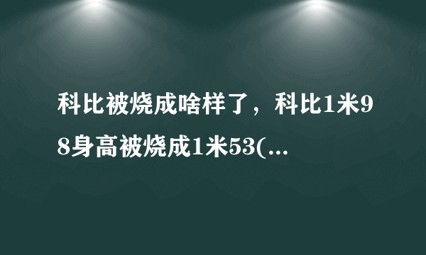 科比被烧成啥样了，科比1米98身高被烧成1米53(下半身没了)—飞外