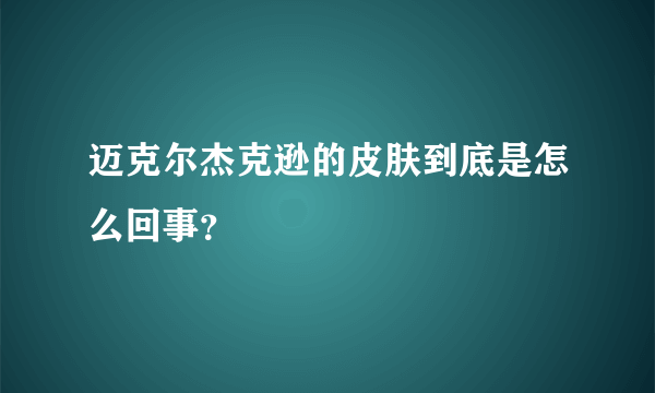 迈克尔杰克逊的皮肤到底是怎么回事？