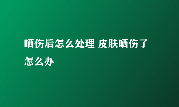 晒伤后怎么处理 皮肤晒伤了怎么办