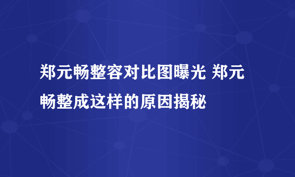 郑元畅整容对比图曝光 郑元畅整成这样的原因揭秘