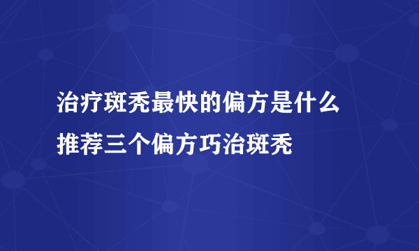 治疗斑秃最快的偏方是什么 推荐三个偏方巧治斑秃