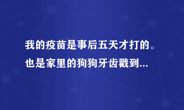 我的疫苗是事后五天才打的。也是家里的狗狗牙齿戳到...