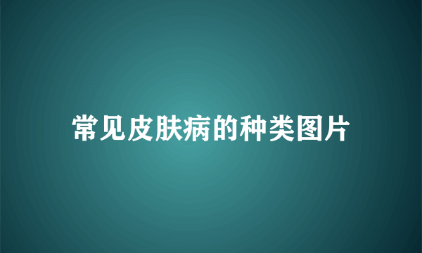 常见皮肤病的种类图片