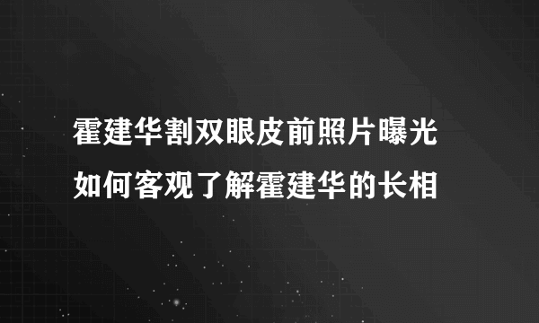 霍建华割双眼皮前照片曝光 如何客观了解霍建华的长相