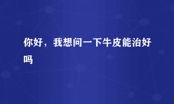 你好，我想问一下牛皮能治好吗