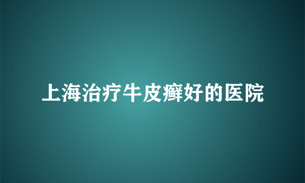 上海治疗牛皮癣好的医院