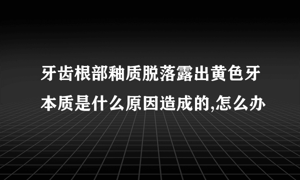 牙齿根部釉质脱落露出黄色牙本质是什么原因造成的,怎么办