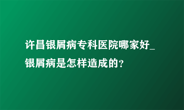 许昌银屑病专科医院哪家好_银屑病是怎样造成的？