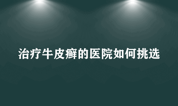 治疗牛皮癣的医院如何挑选