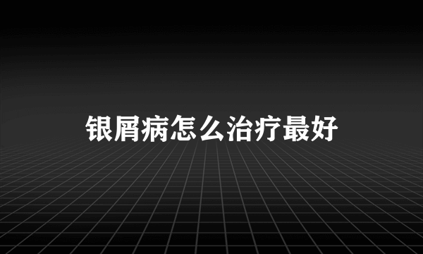 银屑病怎么治疗最好