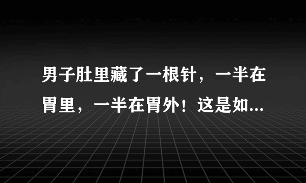 男子肚里藏了一根针，一半在胃里，一半在胃外！这是如何到了胃里的？