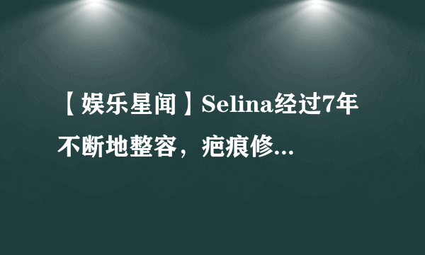 【娱乐星闻】Selina经过7年不断地整容，疤痕修复越来越好，如今长这样