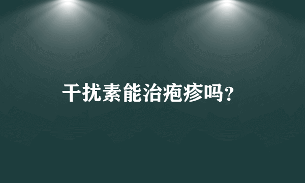 干扰素能治疱疹吗？