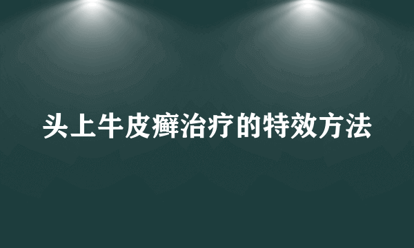 头上牛皮癣治疗的特效方法