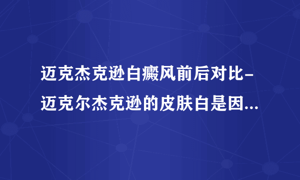 迈克杰克逊白癜风前后对比-迈克尔杰克逊的皮肤白是因为的白癜风吗？