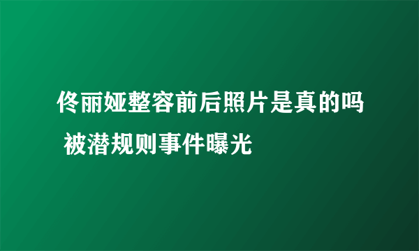 佟丽娅整容前后照片是真的吗 被潜规则事件曝光