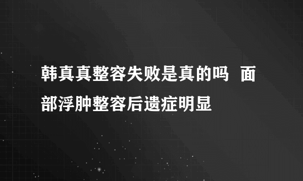 韩真真整容失败是真的吗  面部浮肿整容后遗症明显