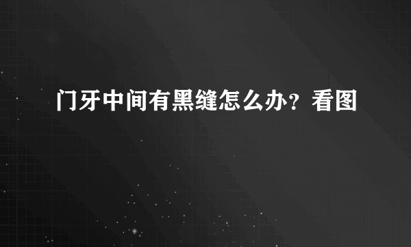 门牙中间有黑缝怎么办？看图