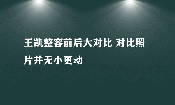 王凯整容前后大对比 对比照片并无小更动