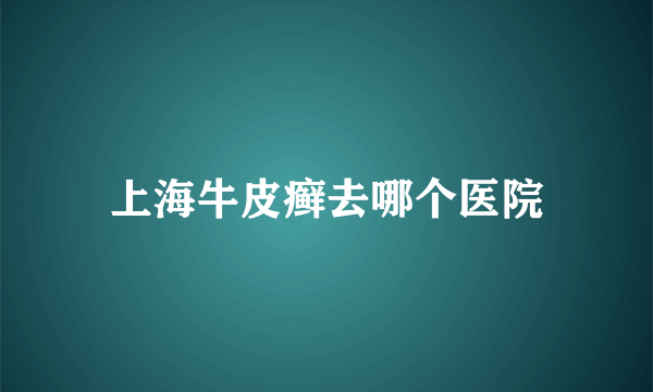 上海牛皮癣去哪个医院