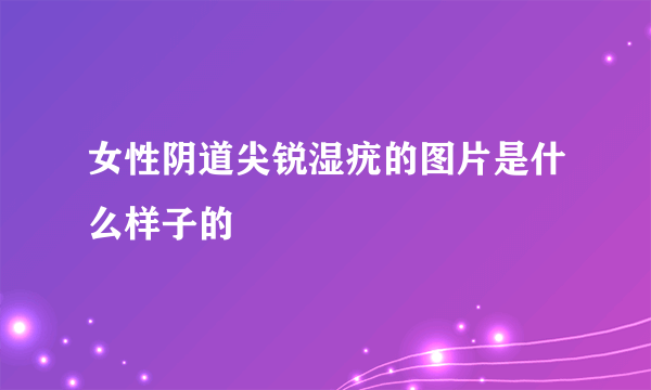 女性阴道尖锐湿疣的图片是什么样子的