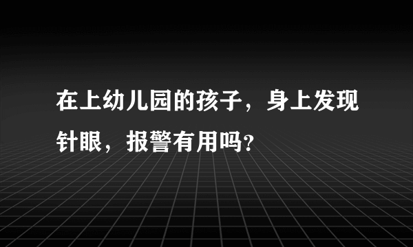 在上幼儿园的孩子，身上发现针眼，报警有用吗？