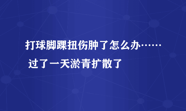 打球脚踝扭伤肿了怎么办…… 过了一天淤青扩散了