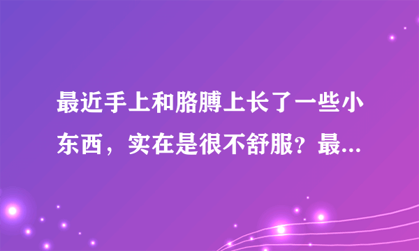 最近手上和胳膊上长了一些小东西，实在是很不舒服？最...