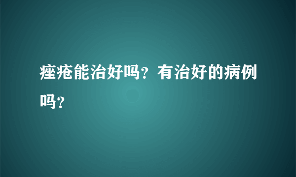 痤疮能治好吗？有治好的病例吗？