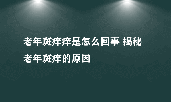 老年斑痒痒是怎么回事 揭秘老年斑痒的原因