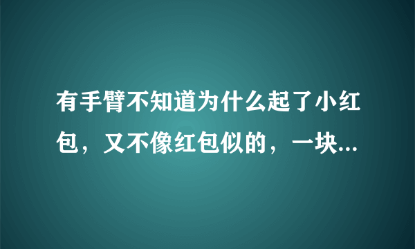 有手臂不知道为什么起了小红包，又不像红包似的，一块...