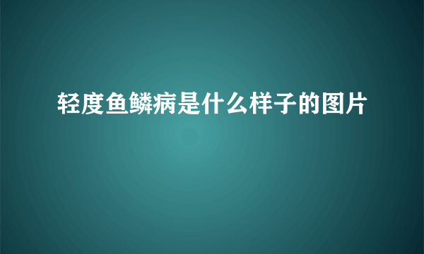 轻度鱼鳞病是什么样子的图片