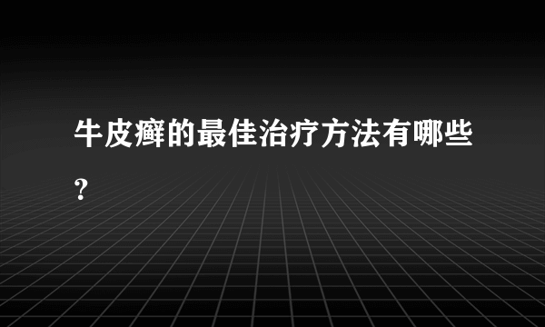 牛皮癣的最佳治疗方法有哪些？