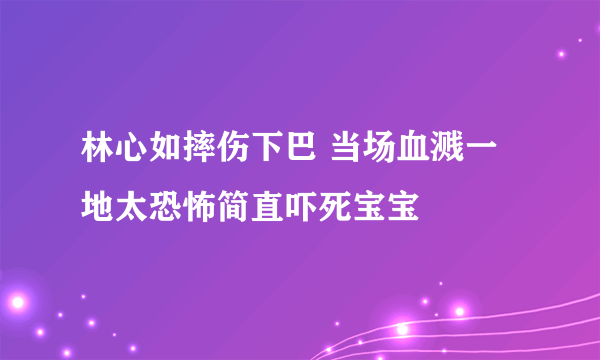 林心如摔伤下巴 当场血溅一地太恐怖简直吓死宝宝