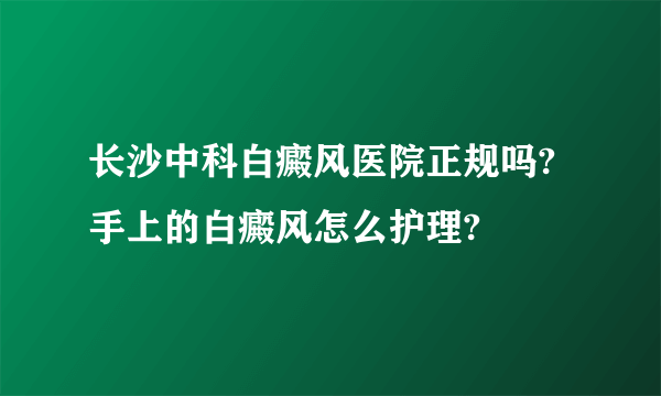 长沙中科白癜风医院正规吗?手上的白癜风怎么护理?