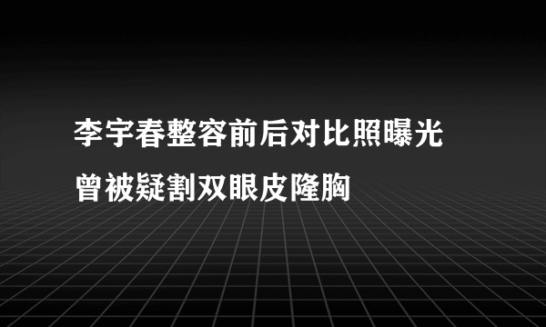 李宇春整容前后对比照曝光 曾被疑割双眼皮隆胸