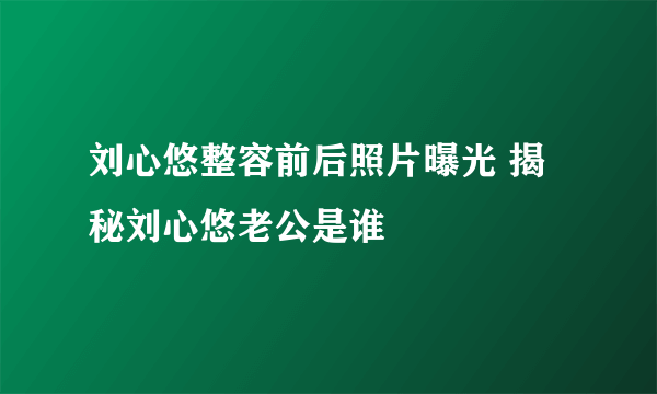 刘心悠整容前后照片曝光 揭秘刘心悠老公是谁