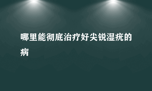 哪里能彻底治疗好尖锐湿疣的病